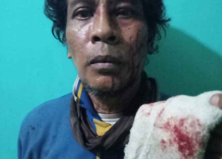  Parbetor Korban Penganiayaan Minta Polisi Segera Tangkap Pelaku