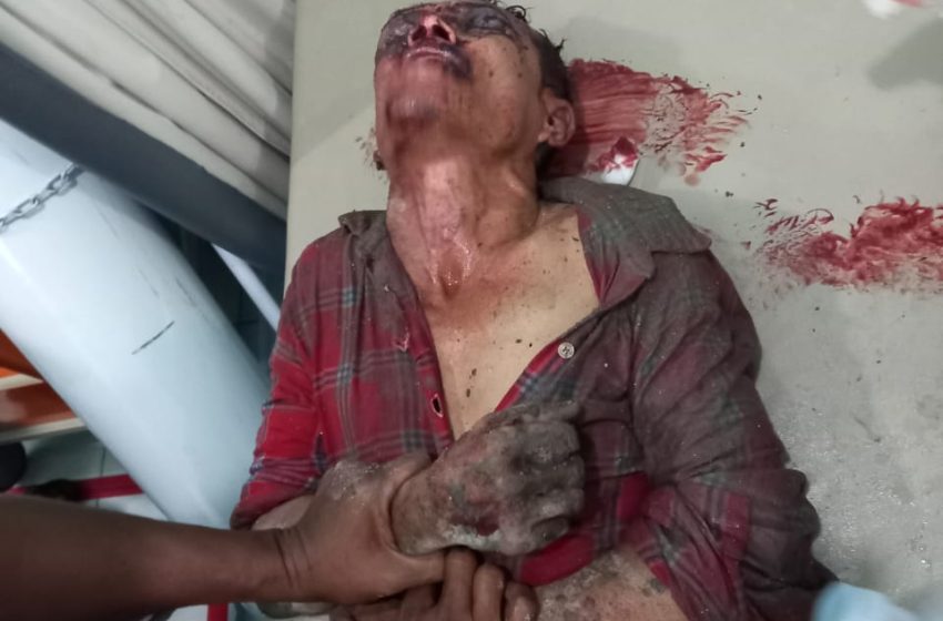  Heboh, Warga Desa Suka Jaya Menemukan Seorang Pria Dibuang Dalam Kondisi Babak Belur dan Koma